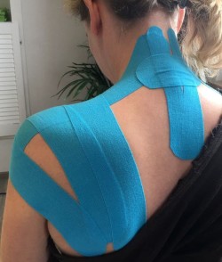 Kinesio Taping Schulter und Nacken